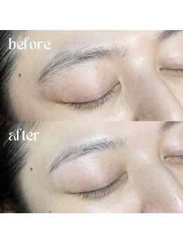 ルーン(rune)/お客様の眉毛ビフォーアフター