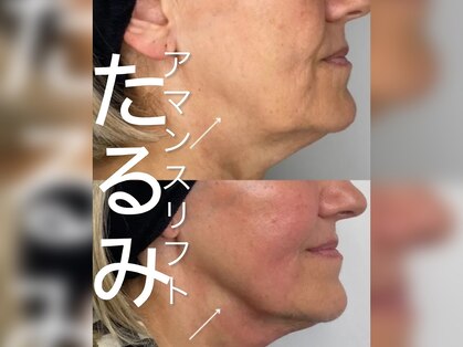 ミリュール(Millule)の写真