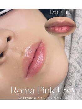 リ クリニカル ラボ(Re clinical Labo)/ローマピンクLip