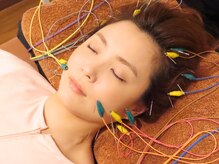 松尾美容鍼灸×整体 香椎/電気鍼施術風景です