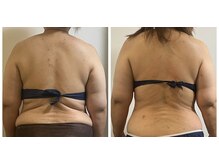 ピンクマジック(PINKMAGIC)/痩身コース（10回コースご利用）