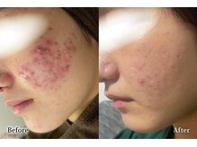 アネル オム 新都心店(ANEL HOMME)/