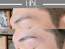 アポロ(Apollo)/ハリウッドブロウリフト