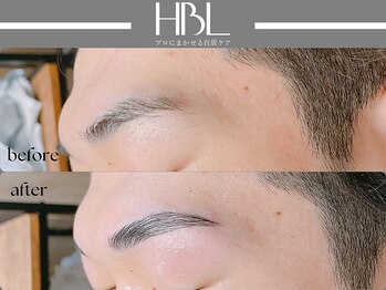 アポロ(Apollo)/ハリウッドブロウリフト