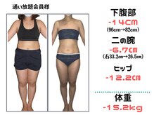 ビューティースリム リボーン 銀座店(reborn)/【痩身】体のラインに変化