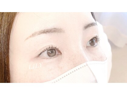 リリー(LILY)の写真