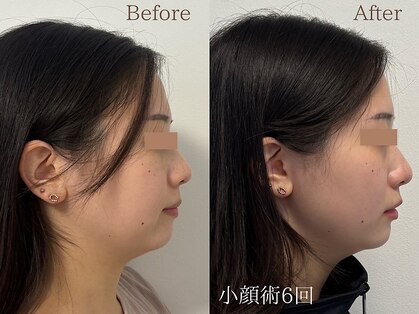 ライフサロン 天神(Life Salon)の写真