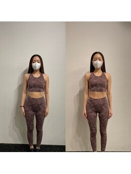 ビヨンド 札幌大通店(BEYOND)/女性 2ヶ月のビフォーアフター