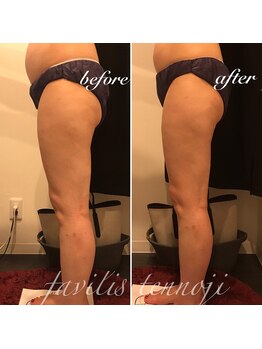 ファビリス 天王寺店(FAVILIS)/痩身/マッサージ