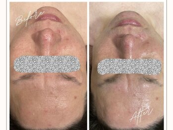 アイラッシュサロン ブラン イオンモール幕張新都心店(Eyelash Salon Blanc)/メンズ限定★ドライベッドスパ