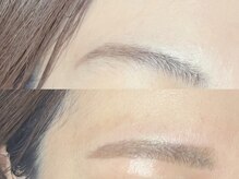 イイテ(iite)/上下ラッシュリフト