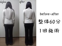 before-after（1回）胸が開き足が整うことで立ち姿が変化