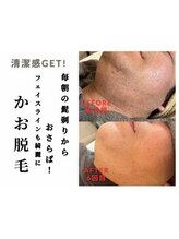 ミラク(MIRAC)/メンズ顔脱毛♪
