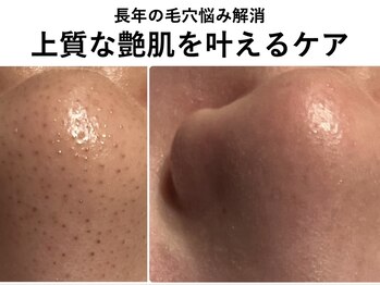 ナチュラーレ 京都四条烏丸店(Naturale)/美肌ニキビケア小顔フェイシャル