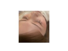 あてやか