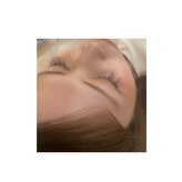 あてやか