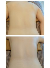 ムーンブロッサム(MoonBlossom)/上半身or下半身キャビ+手技