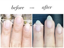 ユナールネイル(YUNA.L Nail)