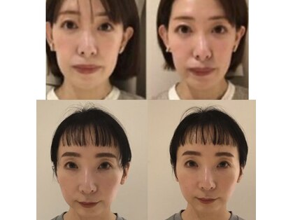 マーノ(mano)の写真