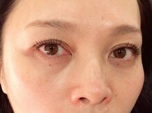 トミー(Tommy)/大人女子の為の上品エクステ