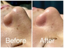 フィールグルック(Viel Gluck)/BLACKフェイシャル