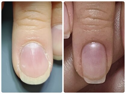 サエコ ネイル (3e5 nail)の写真