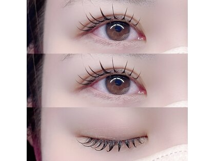 ウニ(uni)の写真