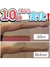 ミムー/before／after