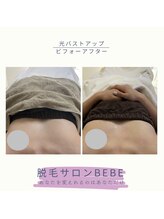 ベベ(Bebe)/ふわふわマシュマロバストアップ