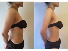 イデアール(Ideal)の雰囲気(ただ痩せるだけじゃ物足りない!辛いコリも改善5歳若見えボディ)