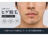 学生メンズ脱毛口周り1100円