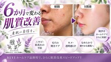 雅菜(miyabina)