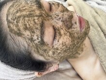 ヨハク 市川店(yohaku)/HERMOSAハーブピーリング