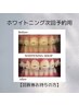 【回数券をお持ちの方】ホワイトニング次回予約用クーポン￥0