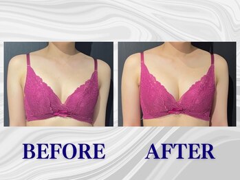 ザモア 福岡天神(THE MORE)/【症例 Before After】