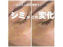 ビジュツ(BIJYUTSU)の雰囲気（プラズマシミケア）