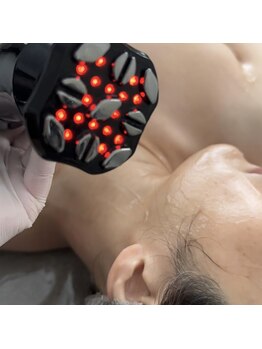 ラウレア(Laule'a)/高周波 RF EMS ポレーション