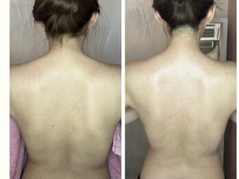 ドゥナ(DUNA)/ブライダル集中1回コース