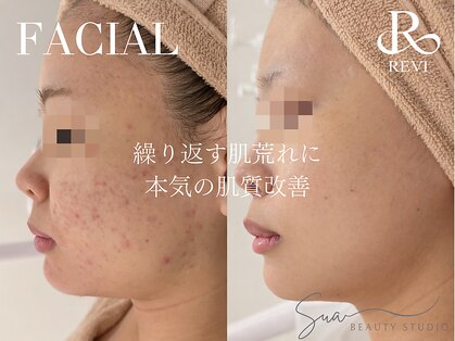 スア ビューティースタジオ(Sua BEAUTYSTUDIO)の写真