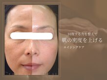 サロン ド ボーテ シャルル(Chaleureux)