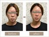 【10・11月限定/先着10名】乾燥・たるみ・くすみ・ハリ不足に肌育60分