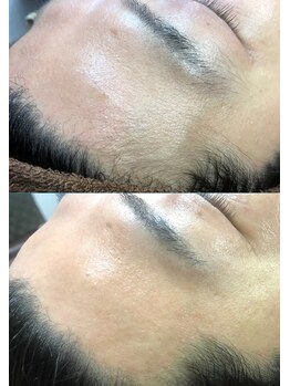 エンジェルワックス 蒲田店(Angel Wax)/【フェイスワックス】