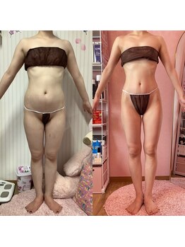 ポノ(Pono)/【痩身】全身ビフォーアフター