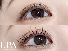 レピア 仙台店/韓国式LEPIA Before&Aｆter