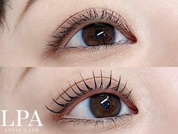 レピア 仙台店/韓国式LEPIA Before&Aｆter