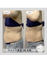 カラー(CALLA)/頑固なお肉もスッキリ☆