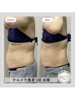 カラー(CALLA)/頑固なお肉もスッキリ☆