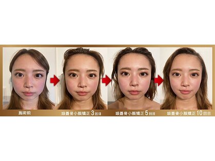 グレースフィオーレ 豊田店(gracefiore)の写真