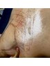 【痩せやすい身体へ！】お悩みを解剖学に基づいて施術！上半身集中70分8000円