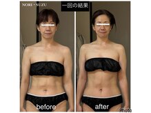 ノリスズ(NORI SUZU)の雰囲気（首は細く長く.肩盛り上がり改善.肩周り華奢.二の腕スッキリ.姿勢）